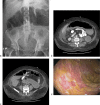 Fig. 1