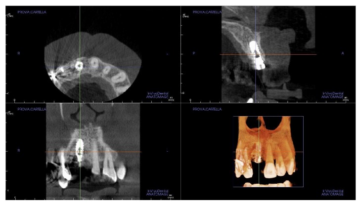 Figure 16