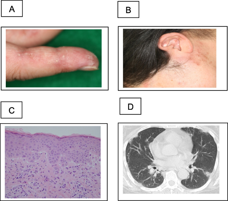 Fig. 1