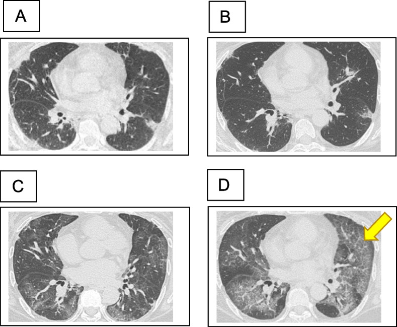 Fig. 2