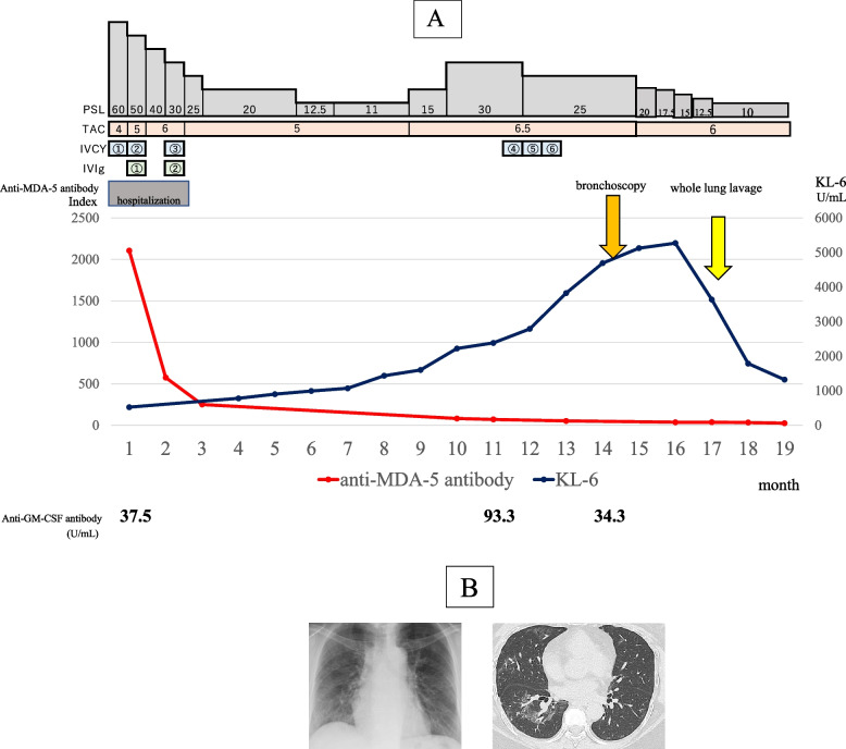 Fig. 4