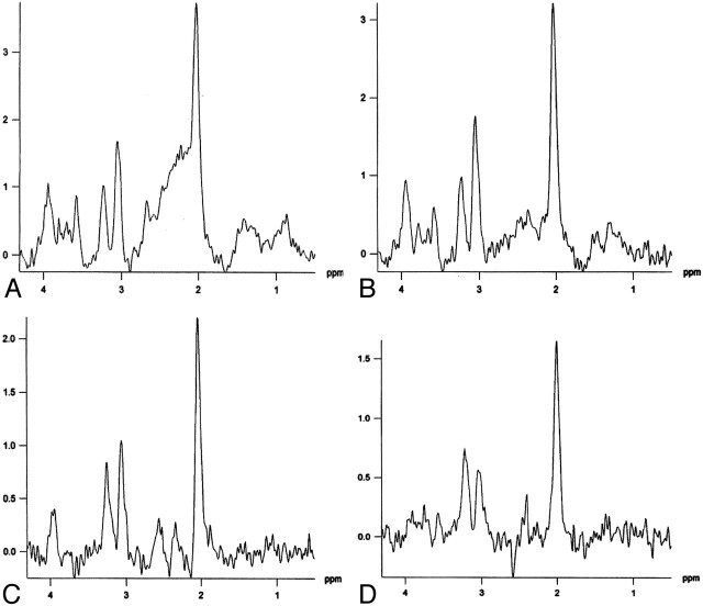 Fig 3.