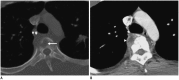 Fig. 19