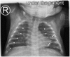 Fig. 15