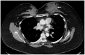 Fig. 9