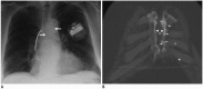 Fig. 22