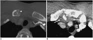 Fig. 20