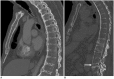 Fig. 12