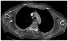 Fig. 11