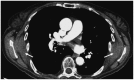 Fig. 21