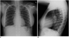 Fig. 16