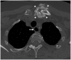 Fig. 10