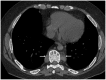 Fig. 17