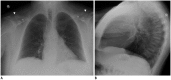 Fig. 14