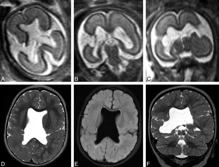 Fig 2.