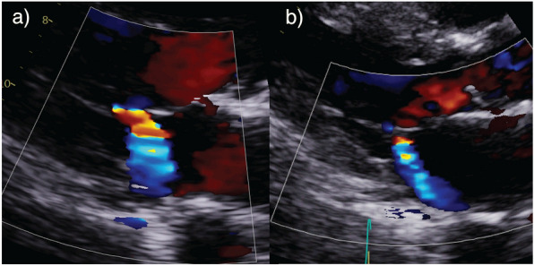 Fig. 7