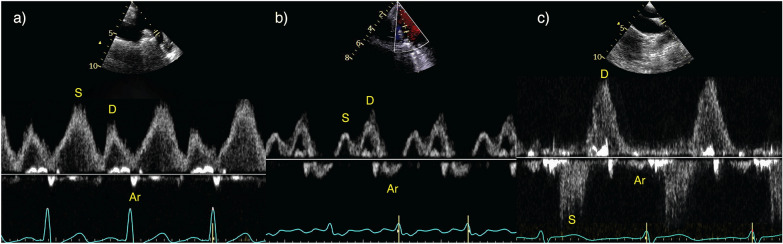 Fig. 10