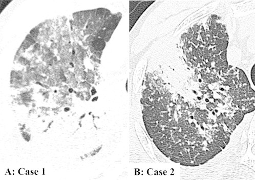 Fig. 1