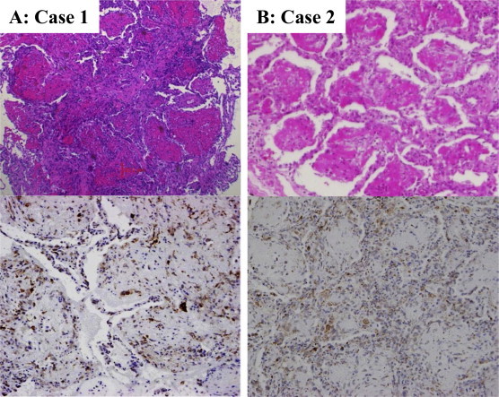 Fig. 2