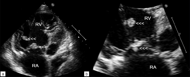 Figure 2: