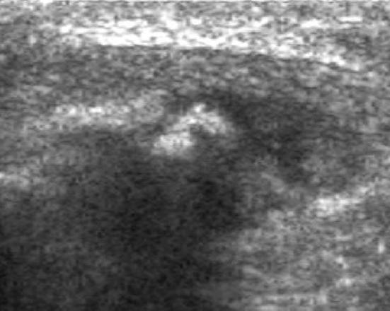 Fig. 12
