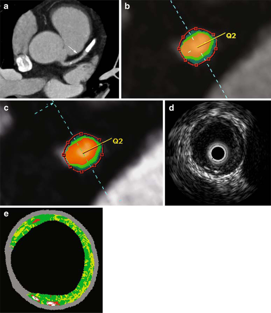 Fig. 6