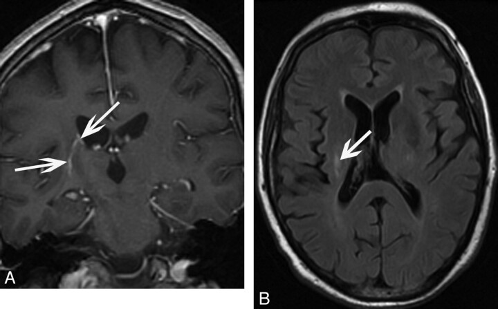 Fig 2.