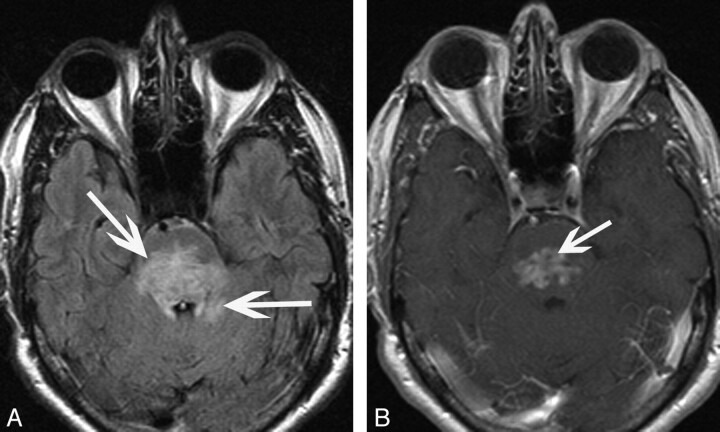 Fig 3.