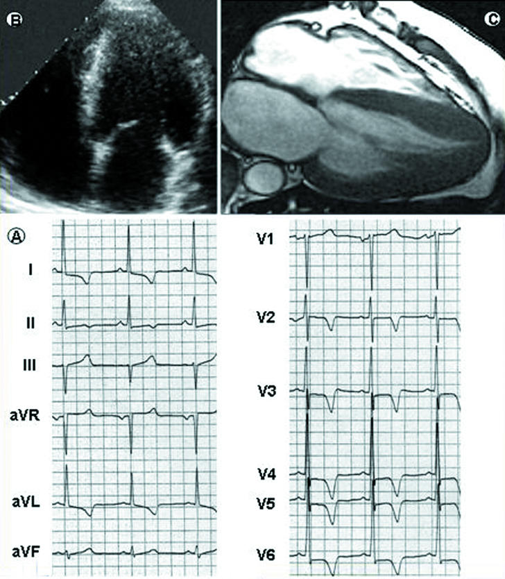 Fig 2