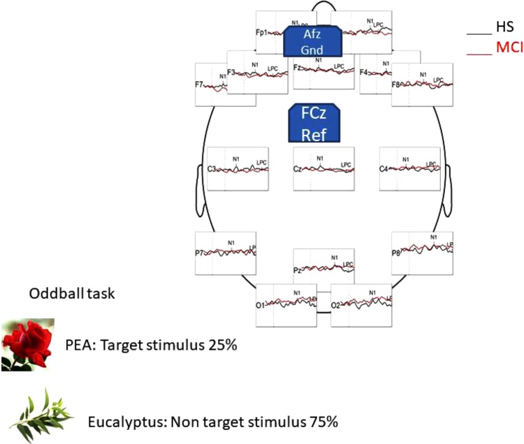 FIGURE 1