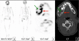 Fig. 10