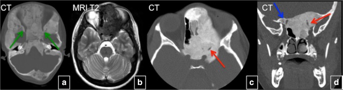 Fig. 19