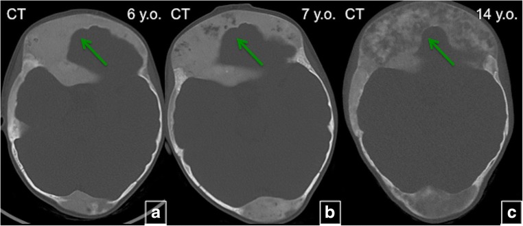 Fig. 13