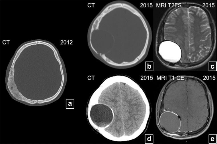 Fig. 21