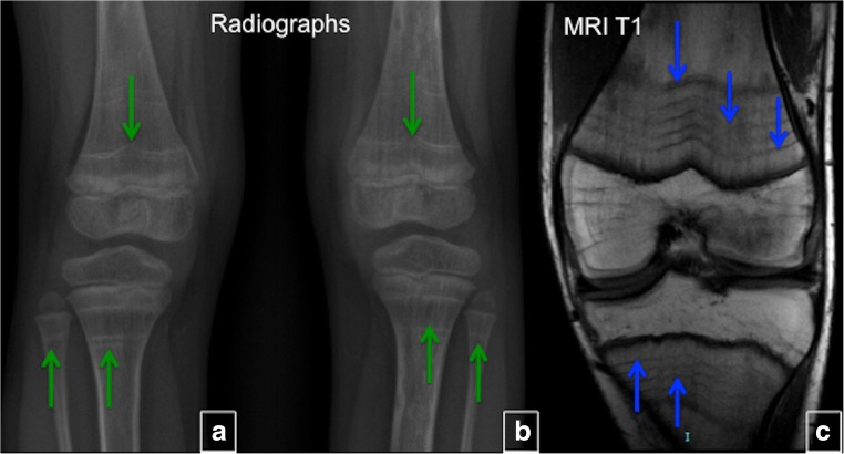 Fig. 14