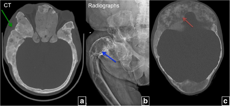 Fig. 4