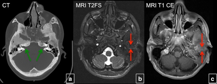 Fig. 20