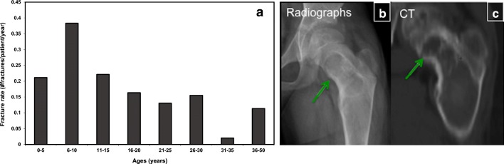 Fig. 15