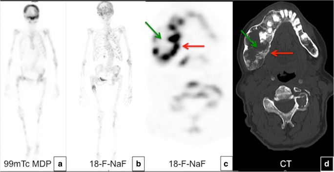 Fig. 10