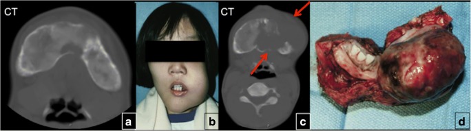 Fig. 18