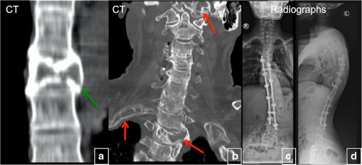 Fig. 22