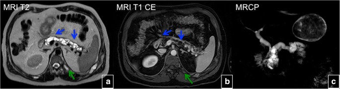 Fig. 28