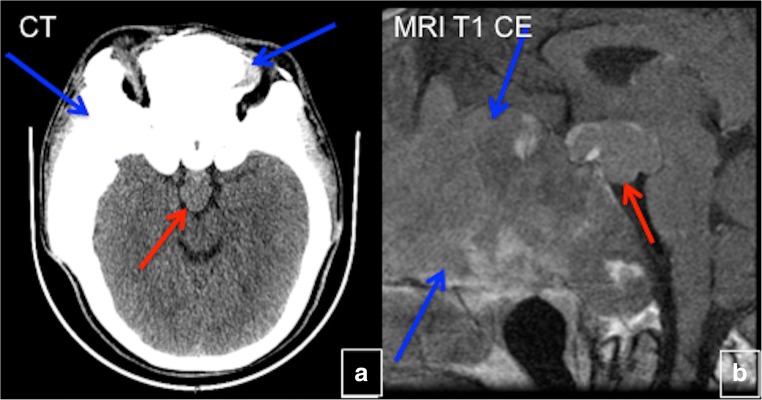 Fig. 27