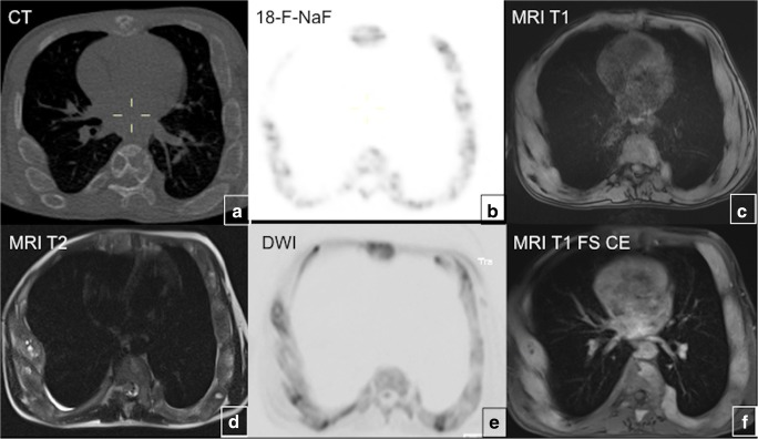 Fig. 11