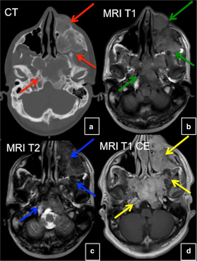 Fig. 8