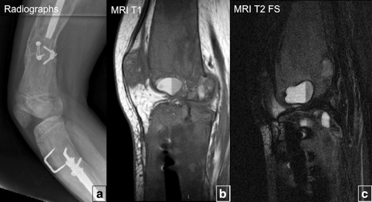 Fig. 16