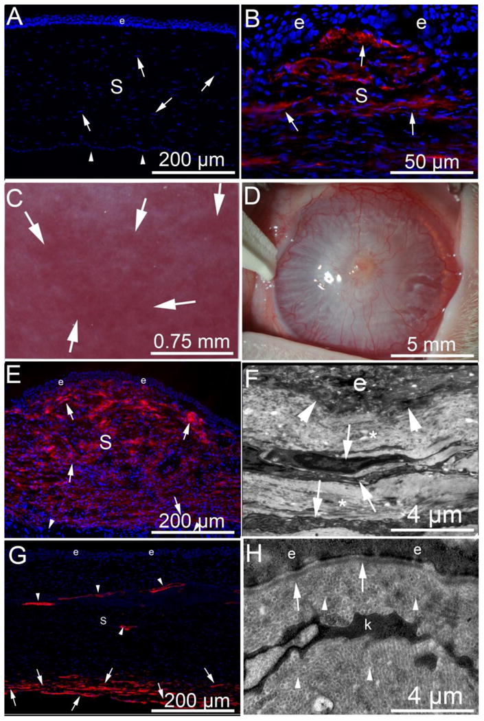 Injury and defective regeneration of the epithelial basement membrane ...