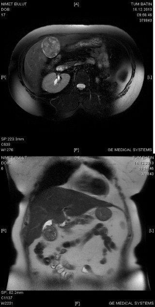 Figs. 3 and 4