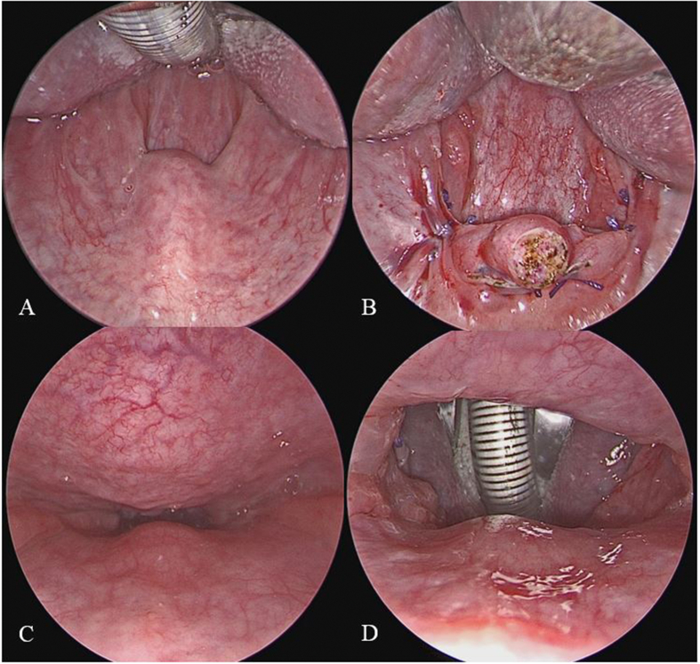 Fig. 5