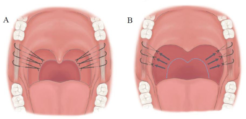 Fig. 4